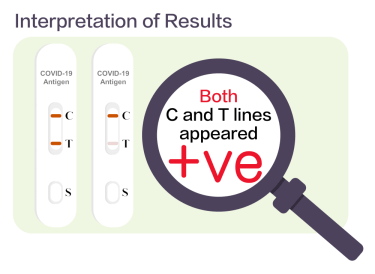 CVG Interpretation of Results - Positive